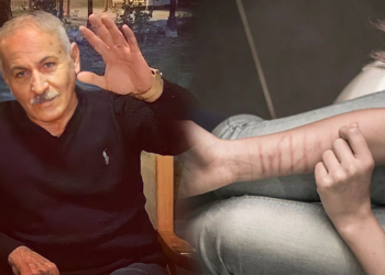 فەرهاد زیرەک وەک سەر هەڵدانی سەمپتۆمی خود-ئازاردان